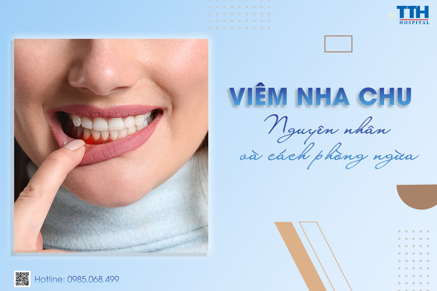 Viêm nha chu - Dấu hiệu và cách phòng ngừa